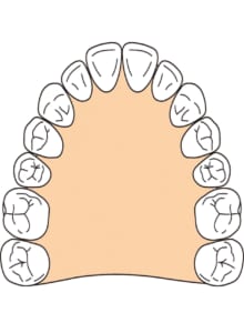 歯の成長力を利用して、歯並びを整えます
