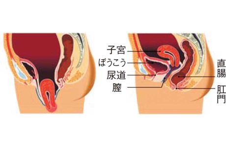 正常な子宮の位置（右）と脱出してしまった子宮の位置（左）