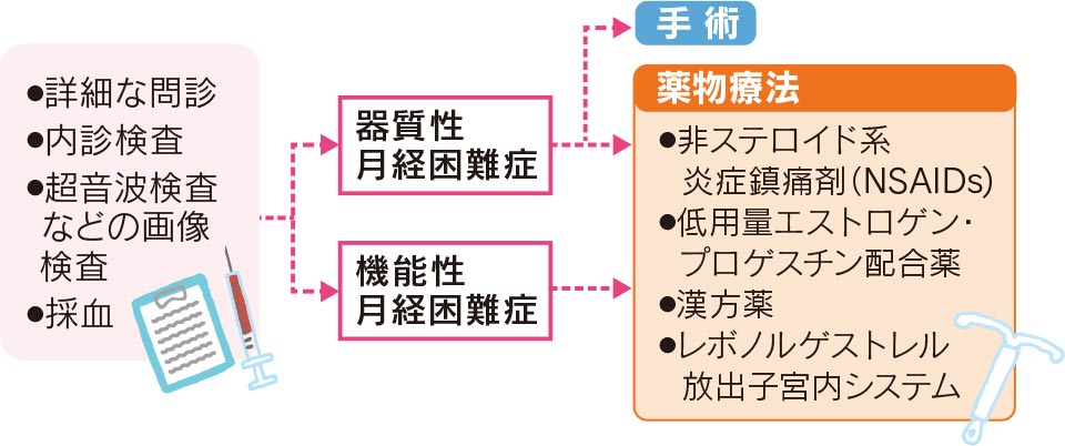 月経困難症の治療