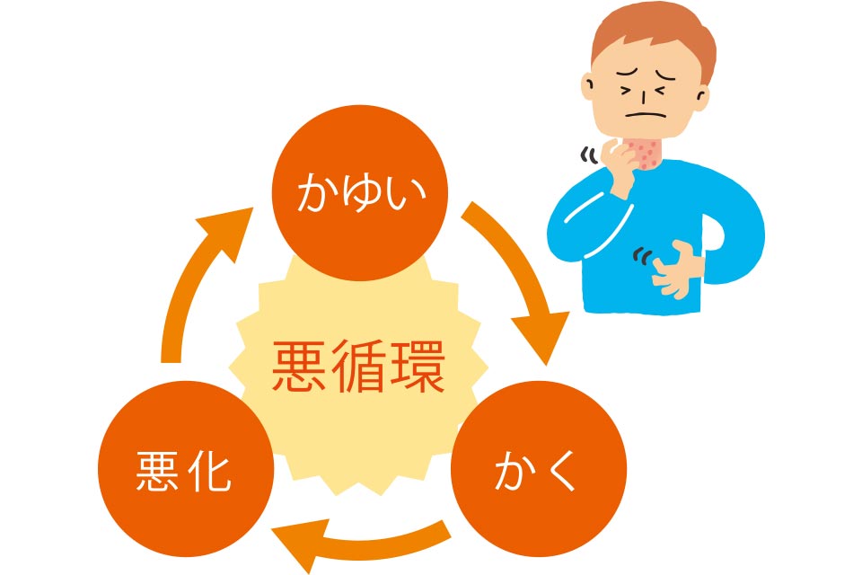 かゆみがひどくなると、無意識に皮膚をかきむしり、症状がさらに悪化するという悪循環に陥ります