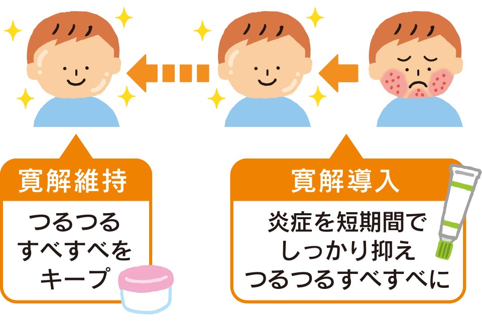 寛解導入で炎症を短期間でしっかり抑えつるつるすべすべに、寛解維持でつるつるすべすべをキープ