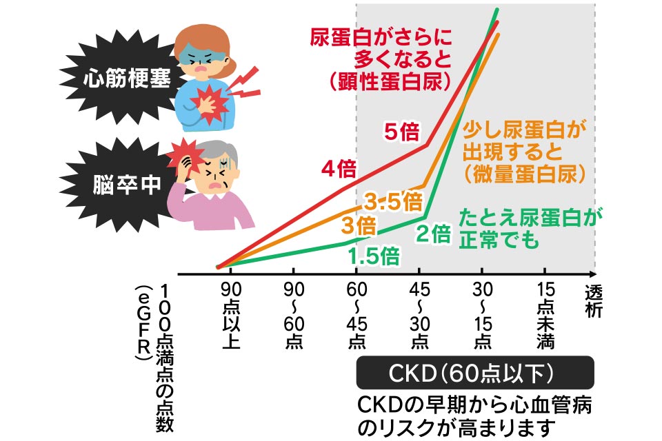 CKD（60点以下）CKDの早期から心血管病のリスクが高まります
