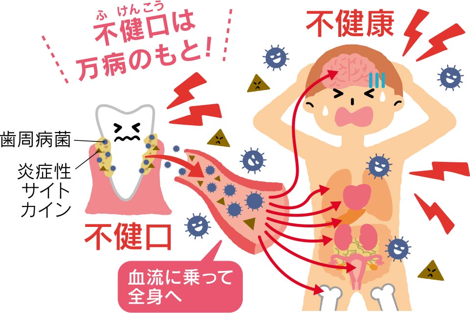 不健康(ふけんこう)は万病のもと!
