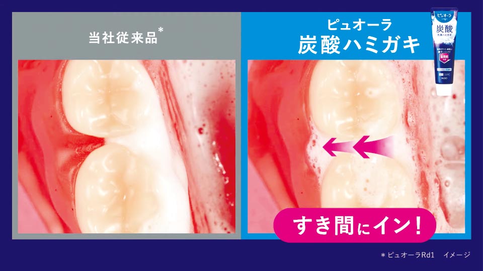 歯磨きを始めると唾液と反応し、炭酸*2泡が発生。この微細な泡が歯間まで*4届くことで、歯周病*6予防をサポートしてくれます。