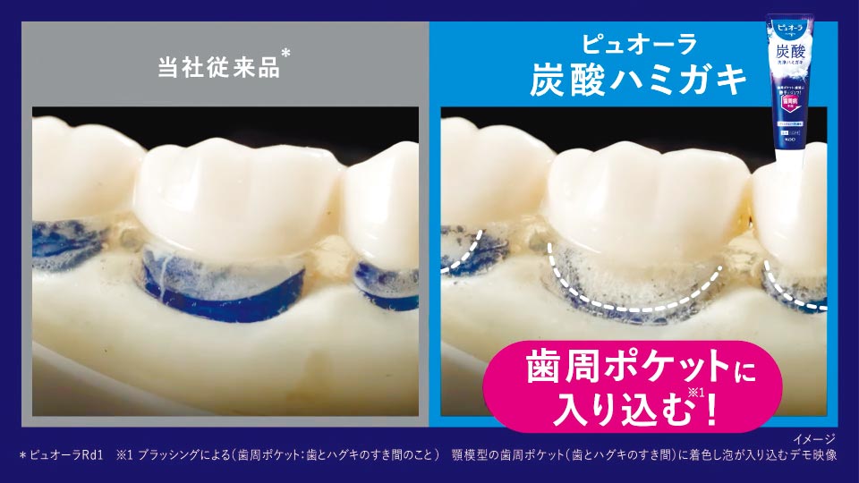 微細な炭酸*2泡がブラッシングで届きにくい歯周ポケット*3 に入り込み、殺菌* 7します。