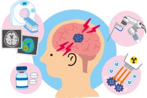 診断や治療の技術が大きく進歩 脳腫瘍