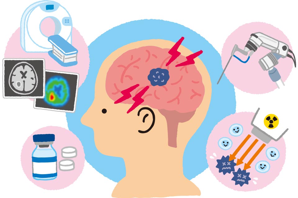 診断や治療の技術が大きく進歩 脳腫瘍
